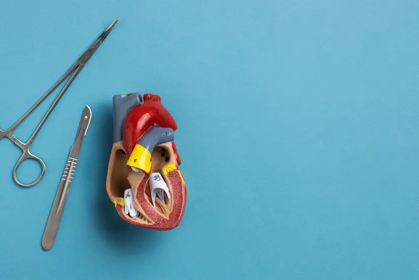 Apa Itu Arteri Koroner Bypass Grafting (CABG)? Ini Penjelasannya